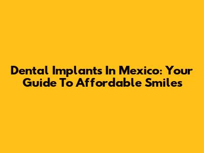 Dental Implants In Mexico: Your Guide To Affordable Smiles