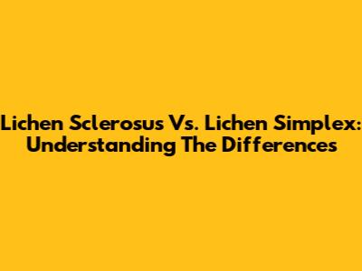 Lichen Sclerosus Vs. Lichen Simplex: Understanding The Differences